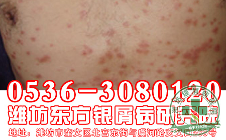 “禽流感”风暴来袭，东方教你未雨绸缪做好防