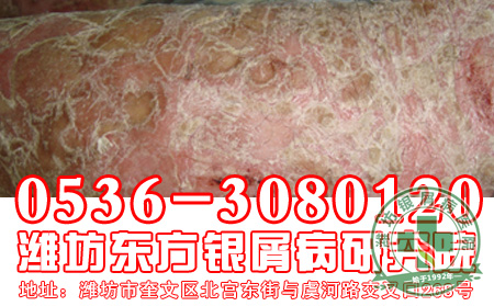 女性银屑病患者会因为什么原因而出现发病?