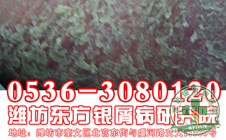 对于银屑病，患者应该怎样做好诊断工作？